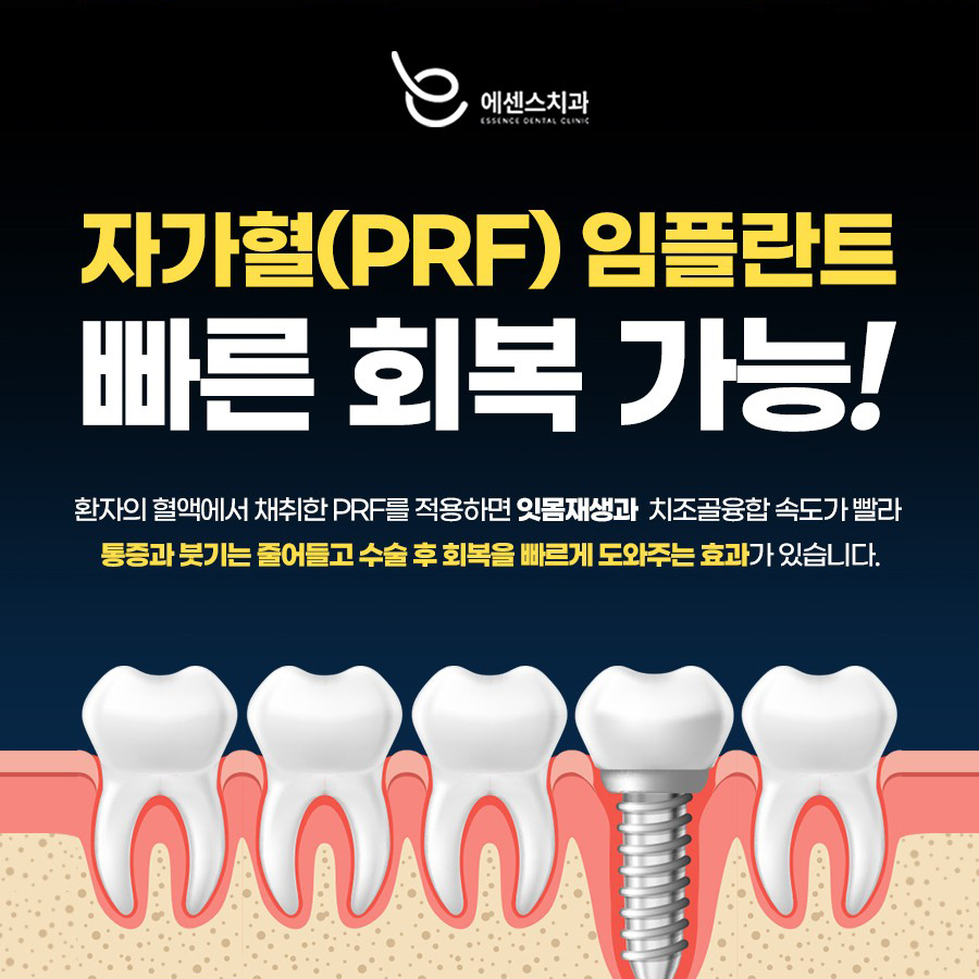 에센스치과 안내 팝업